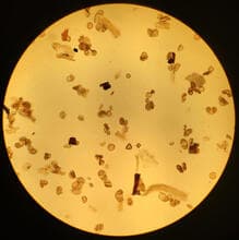 Microscope view supporting pollen forecast tomorrow interpretation